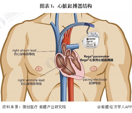 预见2024：《2024年中国心脏起搏器行业全景图谱》(附市场规模、竞争格局和发展前景等)